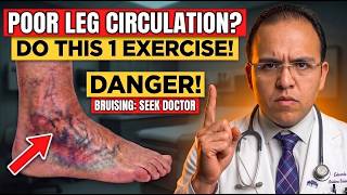 Surgeon Reveals: The #1 Exercise to Improve Leg Circulation After 60 | Dr. Eduardo Perez