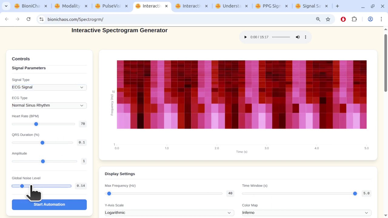 Интерактивное моделирование биомедицинских сигналов: спектрограммы ЭЭГ, ЭКГ и ЭОГ.
