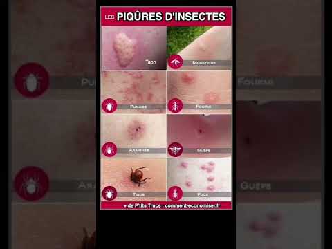 Vidéo: Comment identifier les piqûres d'insectes : 15 étapes (avec photos)