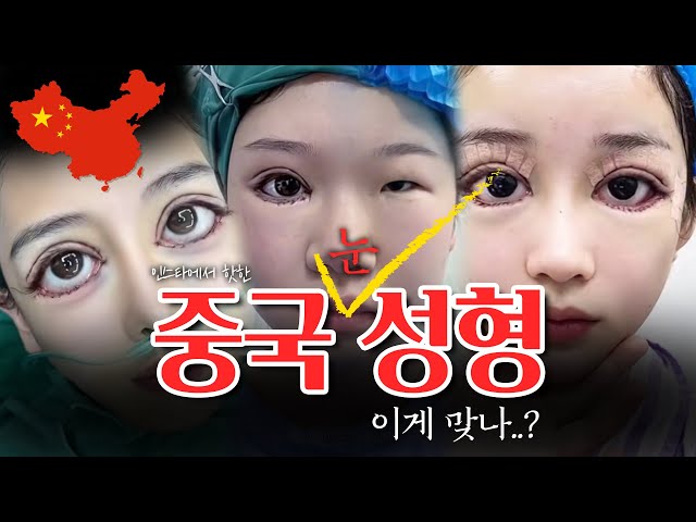 난리 난 중국 성형sns영상!! '누가 만족하는 사람이 있으려나..?'😅😅
