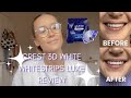 CREST 3D WHITE WHITESTRIPS LUXE REVIEW | 5 DAY TREATMENT | BEFORE & AFTER COMPARISON