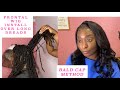 Frontal wig Over long Dreads ( bald cap method ) Truematch lace conceal | WIG INSTALL OVER DREADS