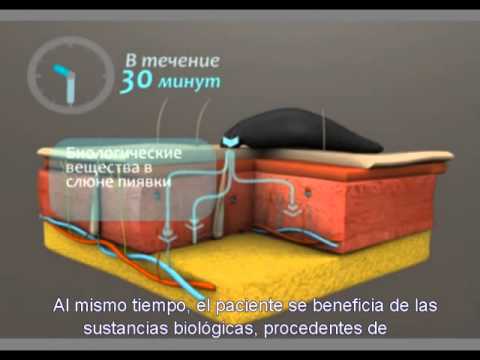 Vídeo: Hirudoterapeuta - Concepto, Especificidad, Servicios