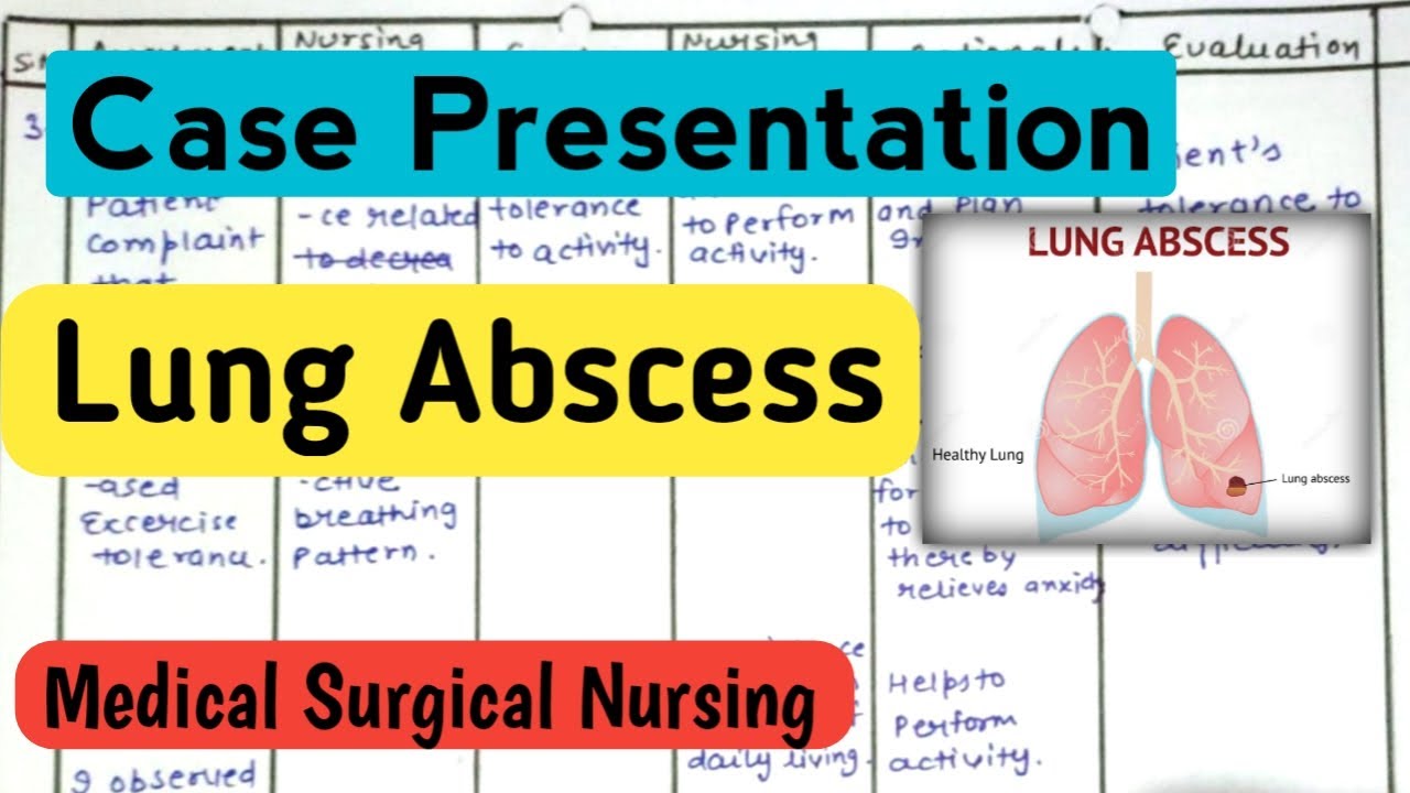 Case Presentation/ Nursing Care Plan/ Case study on Lung Abscess 