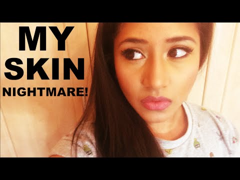 coming-off-birth-control-ruined-my-skin!---the-power-of-makeup