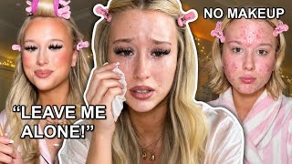 Samara BULLIED For Having “Bad Skin” (She got upset) 