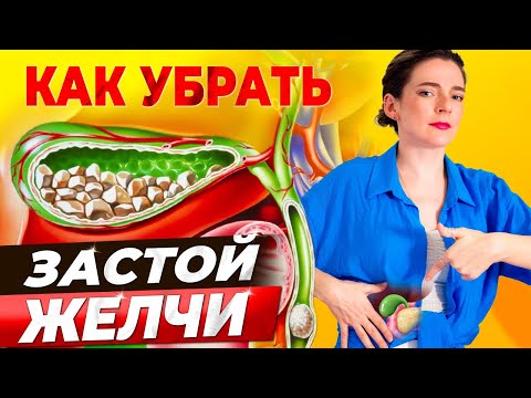 ГУСТАЯ ЖЕЛЧЬ? КАК РАЗОГНАТЬ ЖЕЛЧЬ БЕЗ ЛЕКАРСТВ! Камни, хлопья, сладж, высокий холестерин