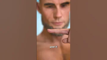 Why You Shouldn T Peel Your Hangnails 