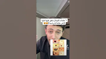 علامات الجمال ال٦ كم وحده عندكم Doctor تعلم Beuty معلومات 
