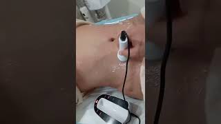 ultrasonido profesional #stetic #S.O.S#ultrasonido#pielbrillante#piel#celulitis#grasalocalizada