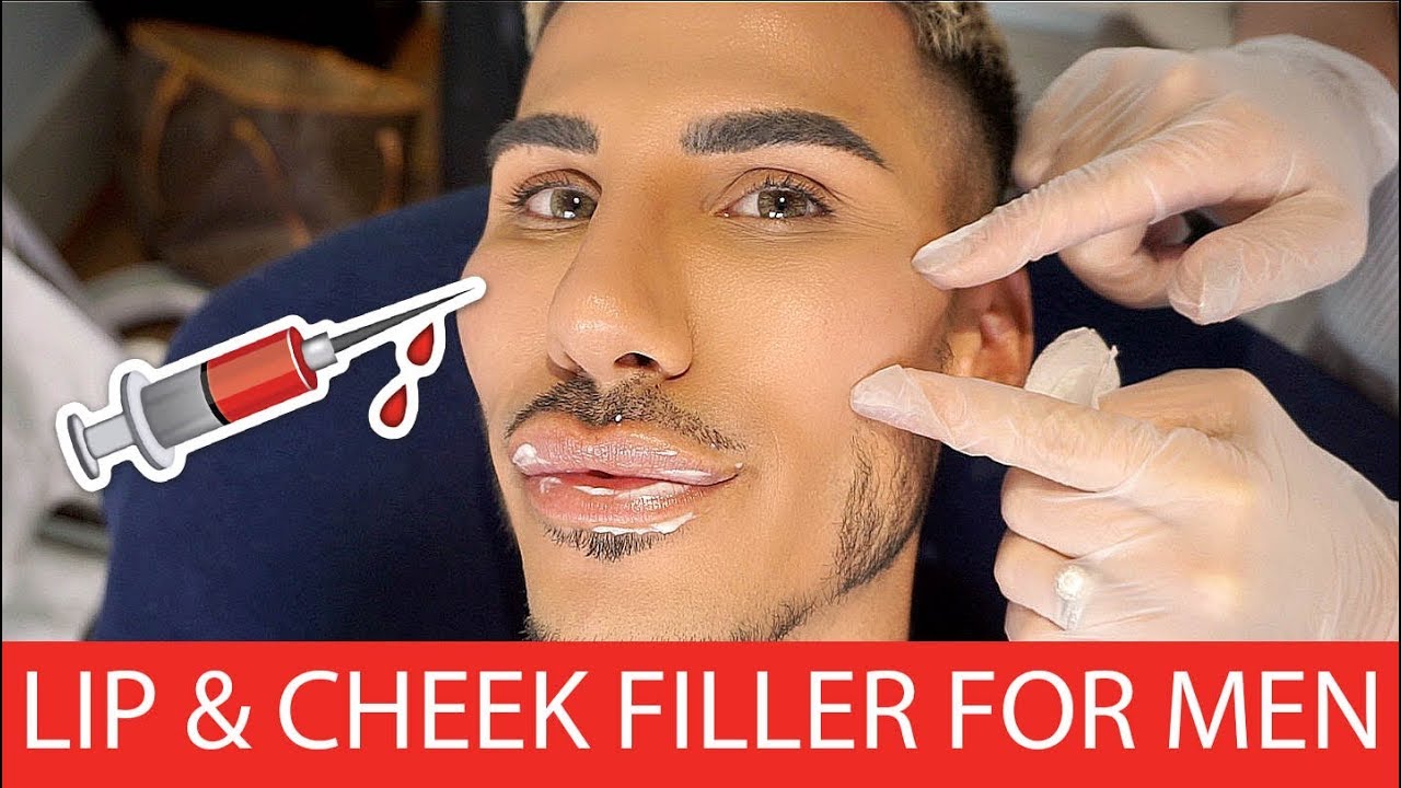LIP & CHEEK FILLER FOR MEN FLAWLESS COSMETIC YouTube
