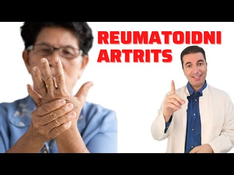 Video: 3 načina da ostanete pozitivni kada imate artritis