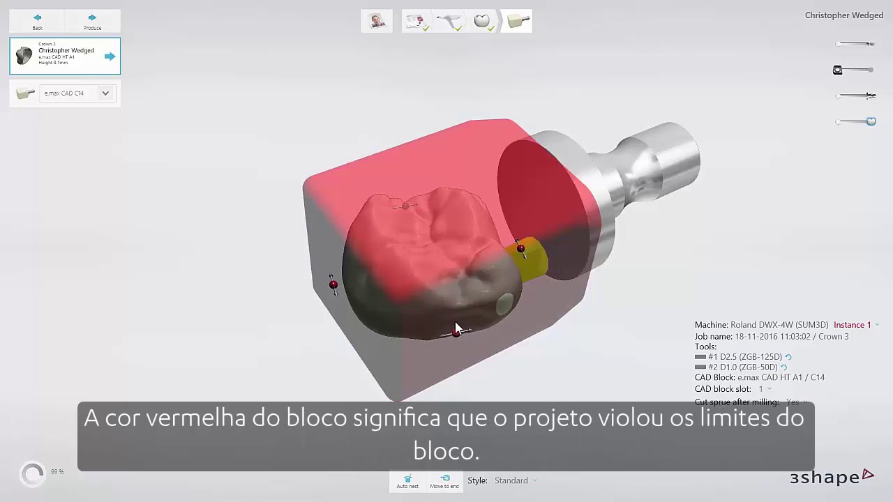 video phone beyonce mp3 3Shape TRIOS Design Studio - Interface do módulo de CAM