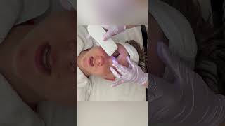 Remove Your Enzyme Treatment With An Ultrasonic Skin Scrubber.