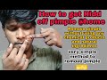 Simple way to remove pimple  how to treat a pimple  does and dont of pimples  tamil  vel