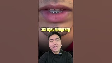 Qúa Trình 385 Ngày Niềng Răng Sẽ Như Thế Nào #nhakhoa #niengrang