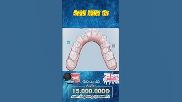 [3D] SCASN RĂNG 3D BIẾT TRƯỚC KẾT QUẢ || Nha Khoa Quốc Tế Athena