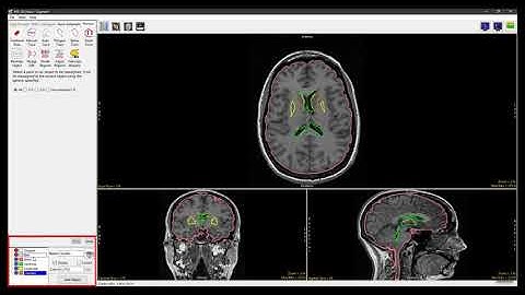 Analyze 14.0 - Segment: Reassign Object