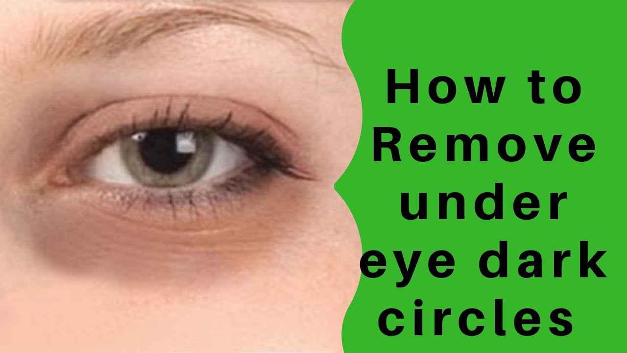 How to Remove Under Eye Dark Circles Magical Home