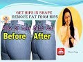 Remove fat from hips | remove hip fats | Get hips in shape