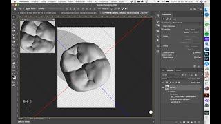 Enceramento Digital - Importando Uma Biblioteca De Dentes