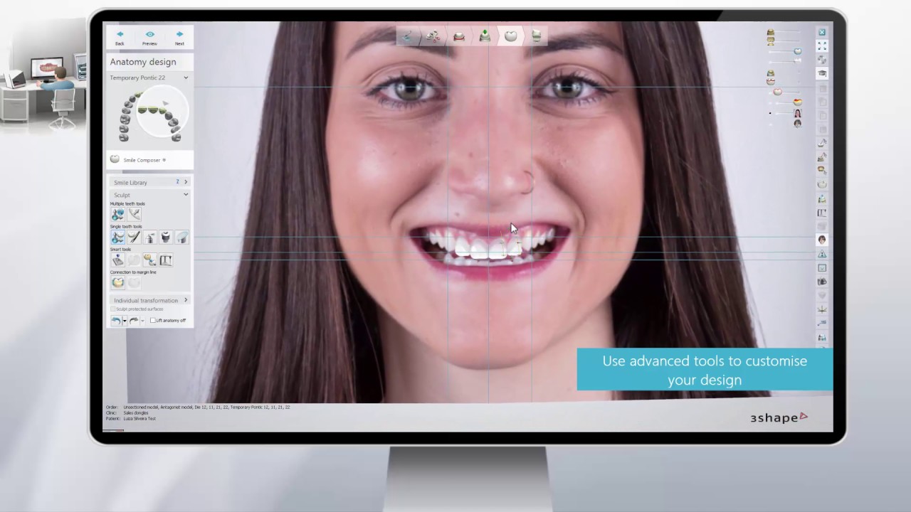 orderform vtex 3 Shape RealView™ Engine Next Generation 3D Digital Smile DesignL