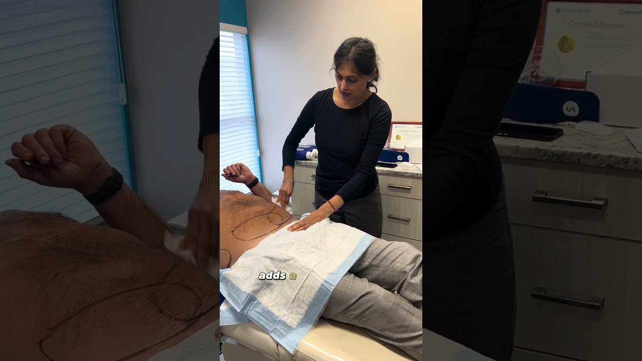 Результаты Coolsculpting Elite для борьбы с упрямым жиром #coolsculptingelite #косметическаядерма...