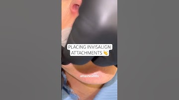 Watch as Dr. Ravi places Invisalign attachments 👏 #ruhdental #invisalign