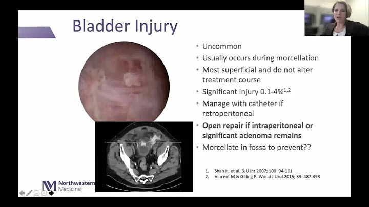 Holmium Laser Enucleation of the Prostate (HOLEP) ...