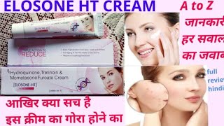 elosone ht skin cream | elosone ht cream ke fayde | elosone ht cream side effects