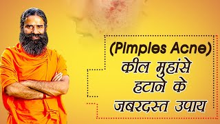 कील – मुहांसे (Pimples,Acne) हटाने के जबरदस्त उपाय | Swami Ramdev screenshot 1