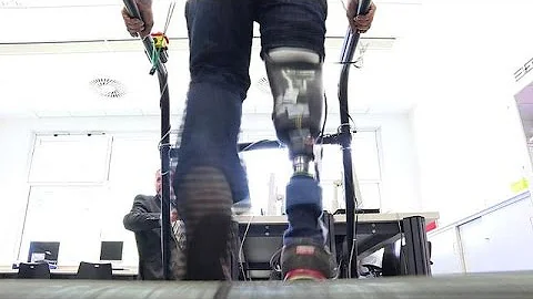 World's first 'feeling' leg prosthesis offers hope to amputees