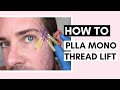 PLLA Mono Thread Lift On Temples | Technique, Tips & How To Insert Threads Ft @Christopher McGrady