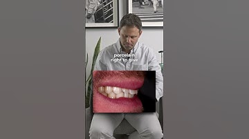 ✨ Transform Your Smile: The Impact of Veneers and Invisalign!