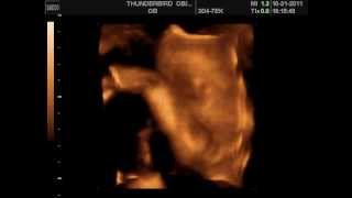 Sofie Rose 3D Ultra Sound @ 27wks