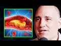 Heart surgeon youve been lied to about cholesterol  heart disease  dr philip ovadia