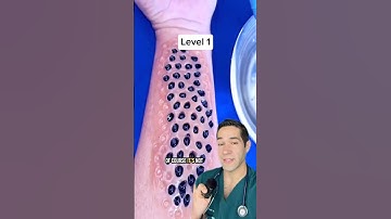 The 4 levels of trypophobia 😳