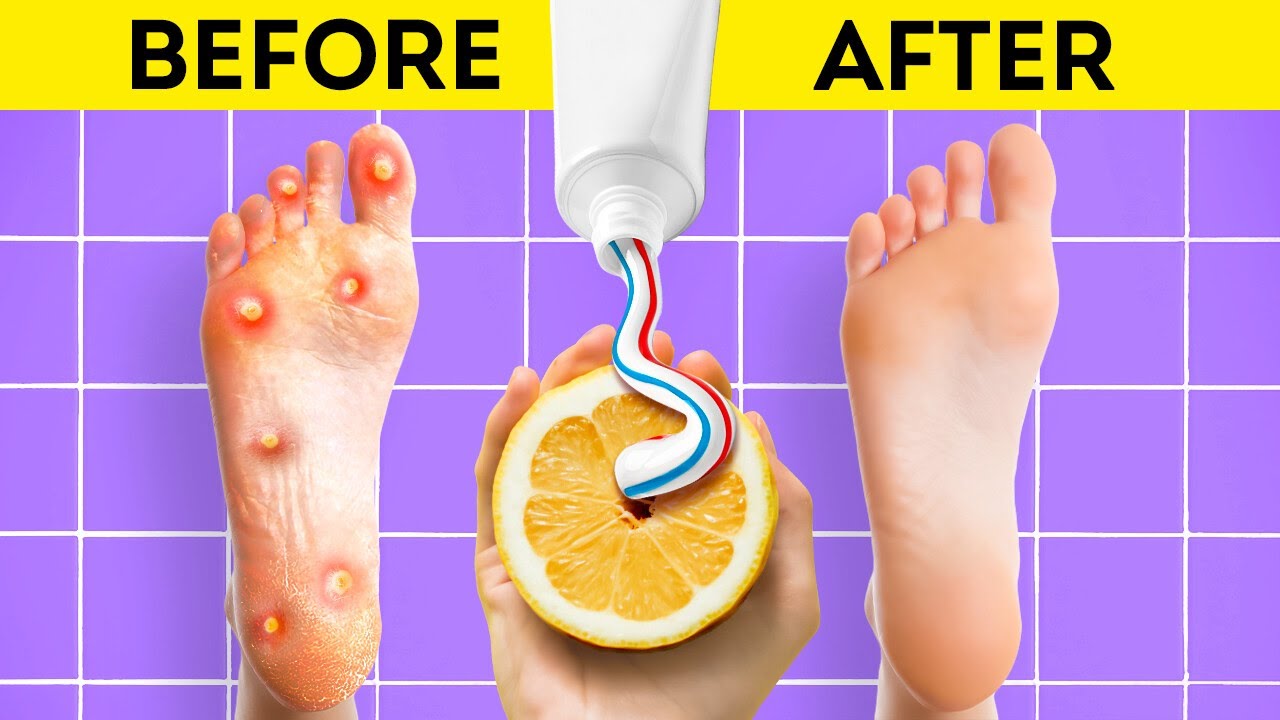 GENIUS FEET CARE HACKS AND PEDICURE TIPS YOU SHOULD TRY