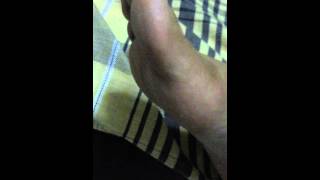 Removing my wifes converse