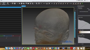 MPHY0026: Mixed Surface and Volume Rendering