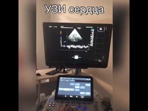 Узи Сердца Рязань Цена