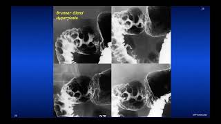 The Duodenum imaging screenshot 4