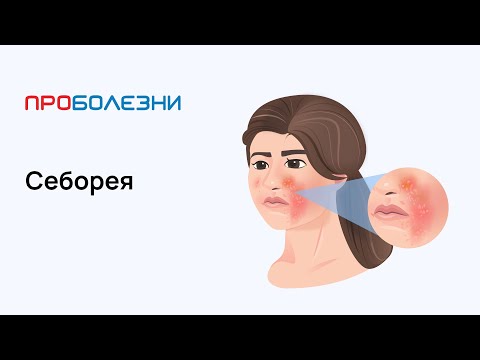 Video: Себорея капитети деген эмне?