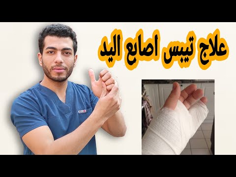 ب 3تمارين بس هتتخلص من تيبس الاصابع بعد الجبس نهائيا |علاج تيبس اصابع اليد