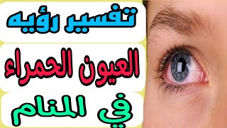 تفسير رؤيه العين الحمراء في المنام/رؤيه احمرار العين في الحلم للرجل والمرأه