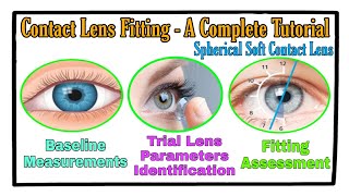 Contact Lens Fitting - A complete Tutorial (Spherical Soft Contact Lens) screenshot 5