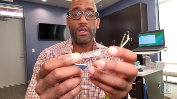 My Invisalign Aligners are Scratching Me (How to deal with Rough Spots)