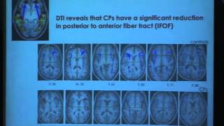 Waterloo Brain Day Lectures 2012: Michael Tarr (CMU) News
