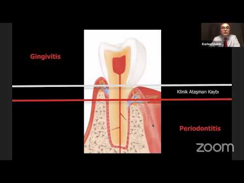 Video: Köpek Diş Hastalığında Porfromonas