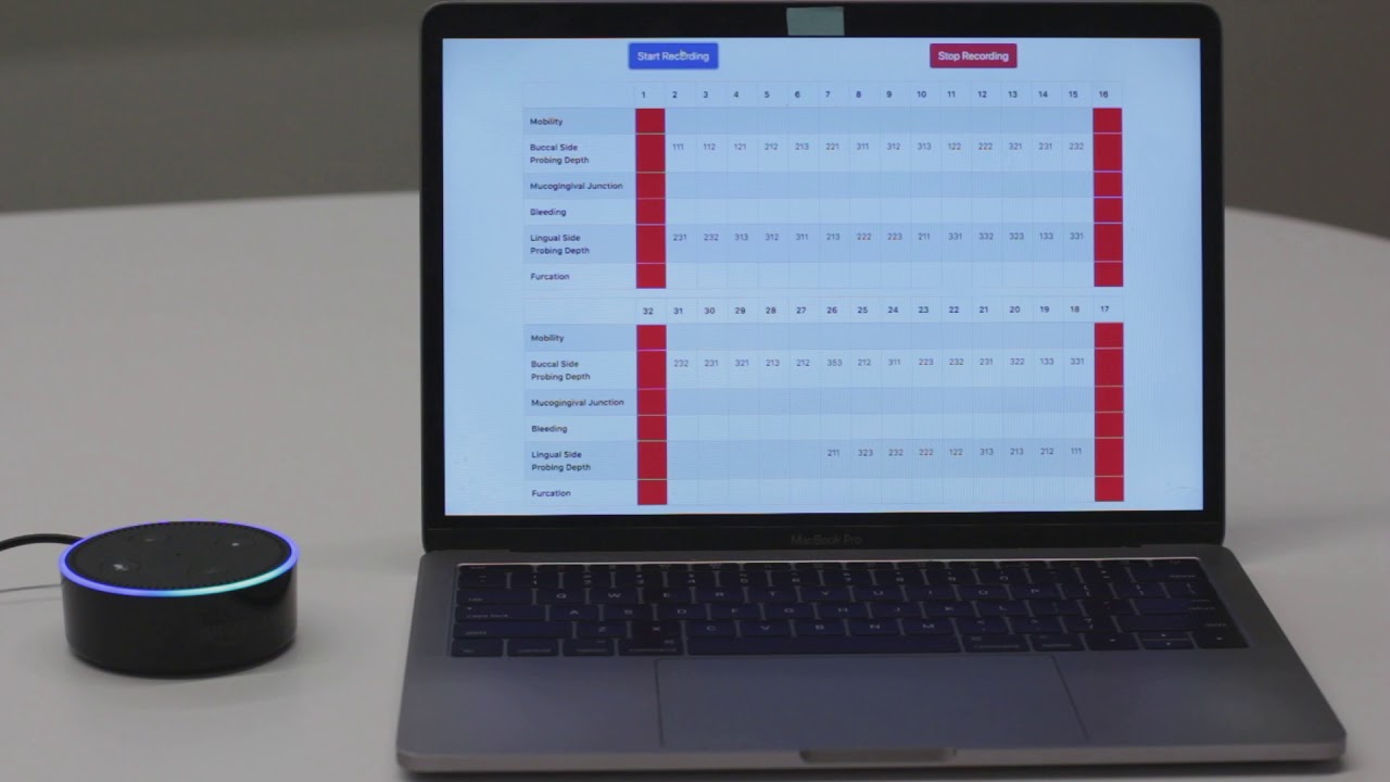 bola dental periodontal charting full charting youtube voice activated periodontal charting